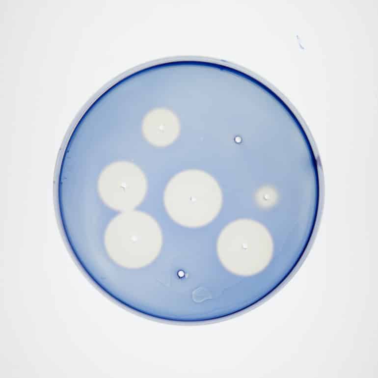 white circles in blue lab dish