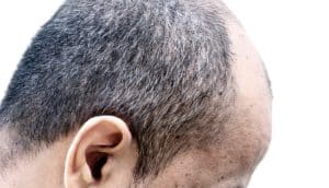 ear and head of man with dark hair