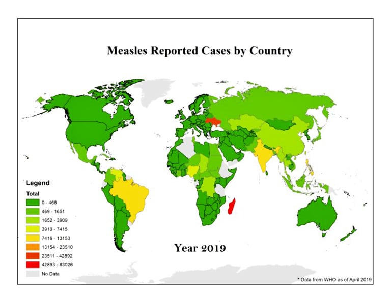 measles world map