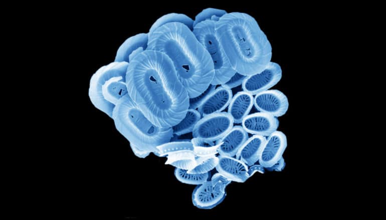 blue SEM image of phytoplankton