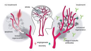 How blocking Nogo-A promotes vascular growth and improves the brain’s capacity to regenerate damaged tissue after stroke