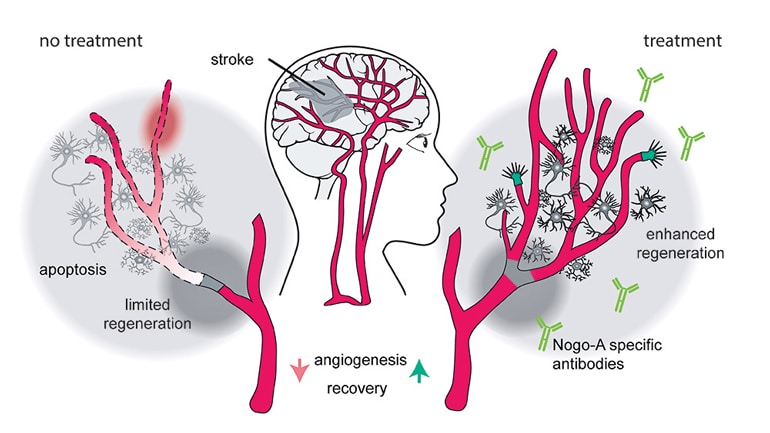 How blocking Nogo-A promotes vascular growth and improves the brain’s capacity to regenerate damaged tissue after stroke