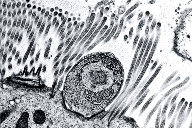 Cryptosporidium