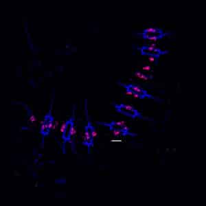 a chain of individual diatom cells stained with a fluorescent dye