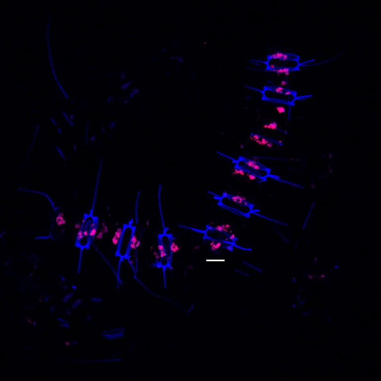 a chain of individual diatom cells stained with a fluorescent dye