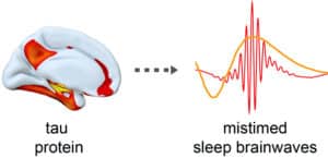Tau in the brain and sleep brainwaves