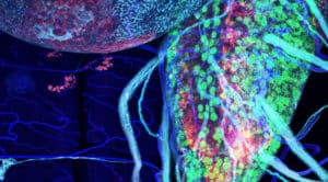 a nerve cord, populated with green-stained motor neurons, expressing human glucose transporters (ALS concept)