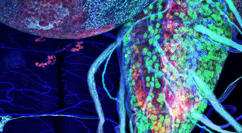 a nerve cord, populated with green-stained motor neurons, expressing human glucose transporters (ALS concept)