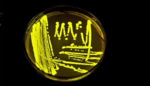 petri dish with bacteria (graphene concept)