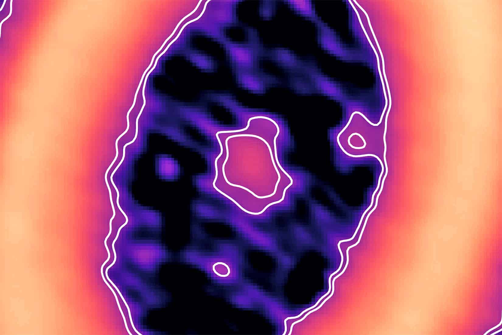 circumplanetary disk