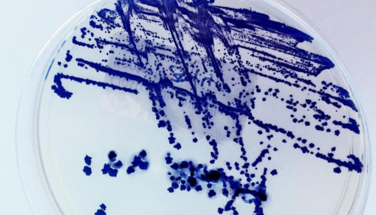 streaks of navy blue cell culture cross a clear petri dish