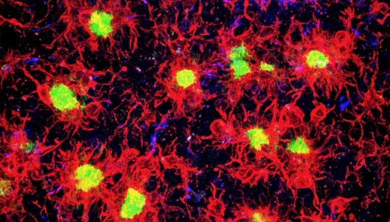 Microglia look like red stains around bright green dots on a black background