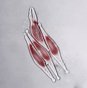 The image shows Phaeodactylum tricornutum diatoms.