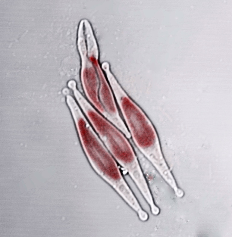 The image shows <em>Phaeodactylum tricornutum</em> diatoms.