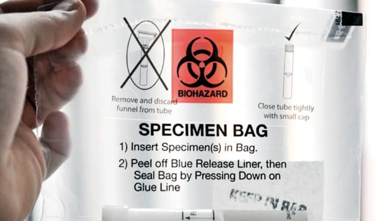 hand holds biohazard specimen bag