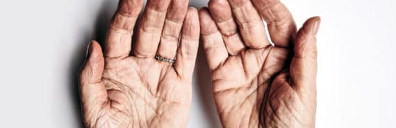 upturned hands of elderly person