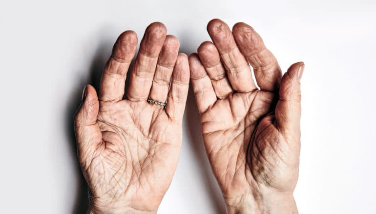 upturned hands of elderly person