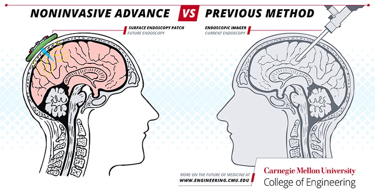 The image shows a comparison of the new noninvasive ultrasound imaging technique and the current invasive technique.