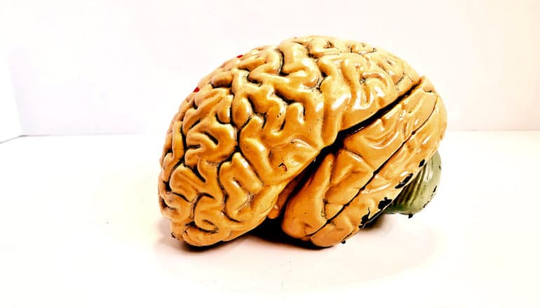 A yellow brain model sits near the corner in a white-walled room