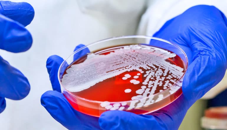gloved hands hold petri dish with red agar and bacterial growth