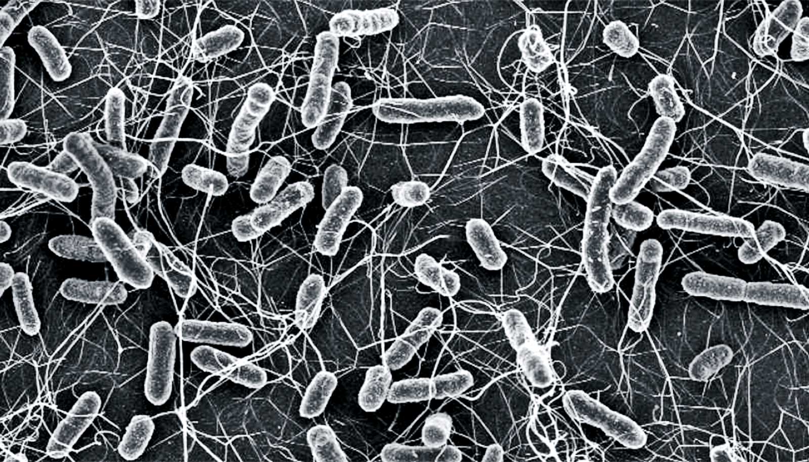Scanning Electron Microscope Images Of Bacteria Micropedia
