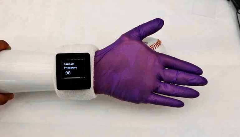 The purple electronic glove covers a prosthetic hand that's reaching for a baseball, with a display showing the pressure the glove senses