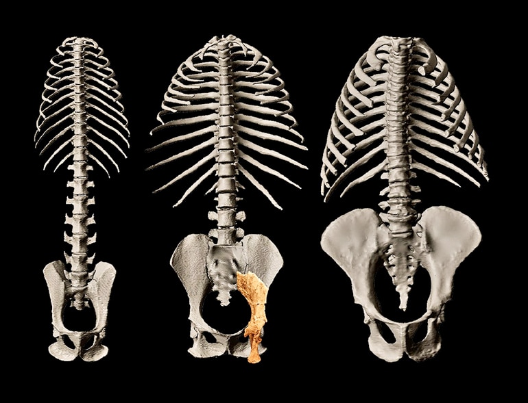 Three sets of rib cages and pelvises sit on a black background, with the Rudapithecus fossil bone over the center pelvis, a poor fit for the other two