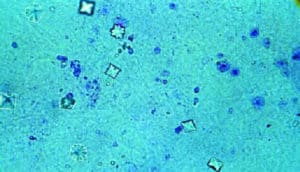 square-ish crystals appear in teal background with blue splotches