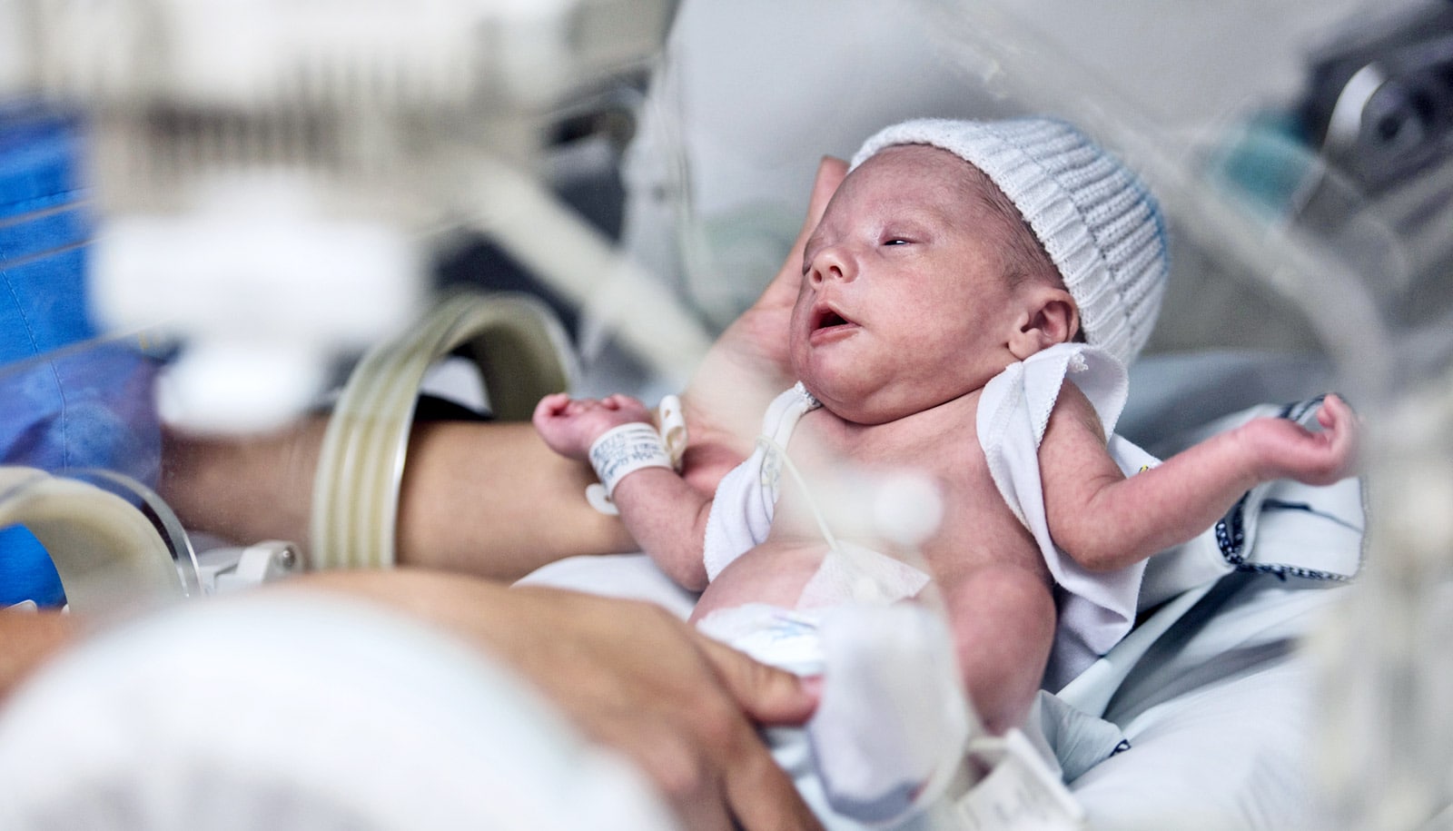 antibiotics-cause-lasting-harm-to-preemie-gut-bacteria-worddisk