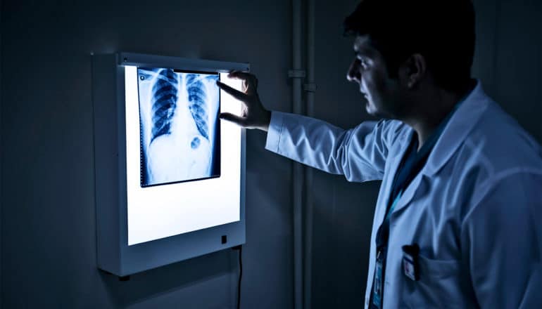 A doctor looks at a lung x-ray
