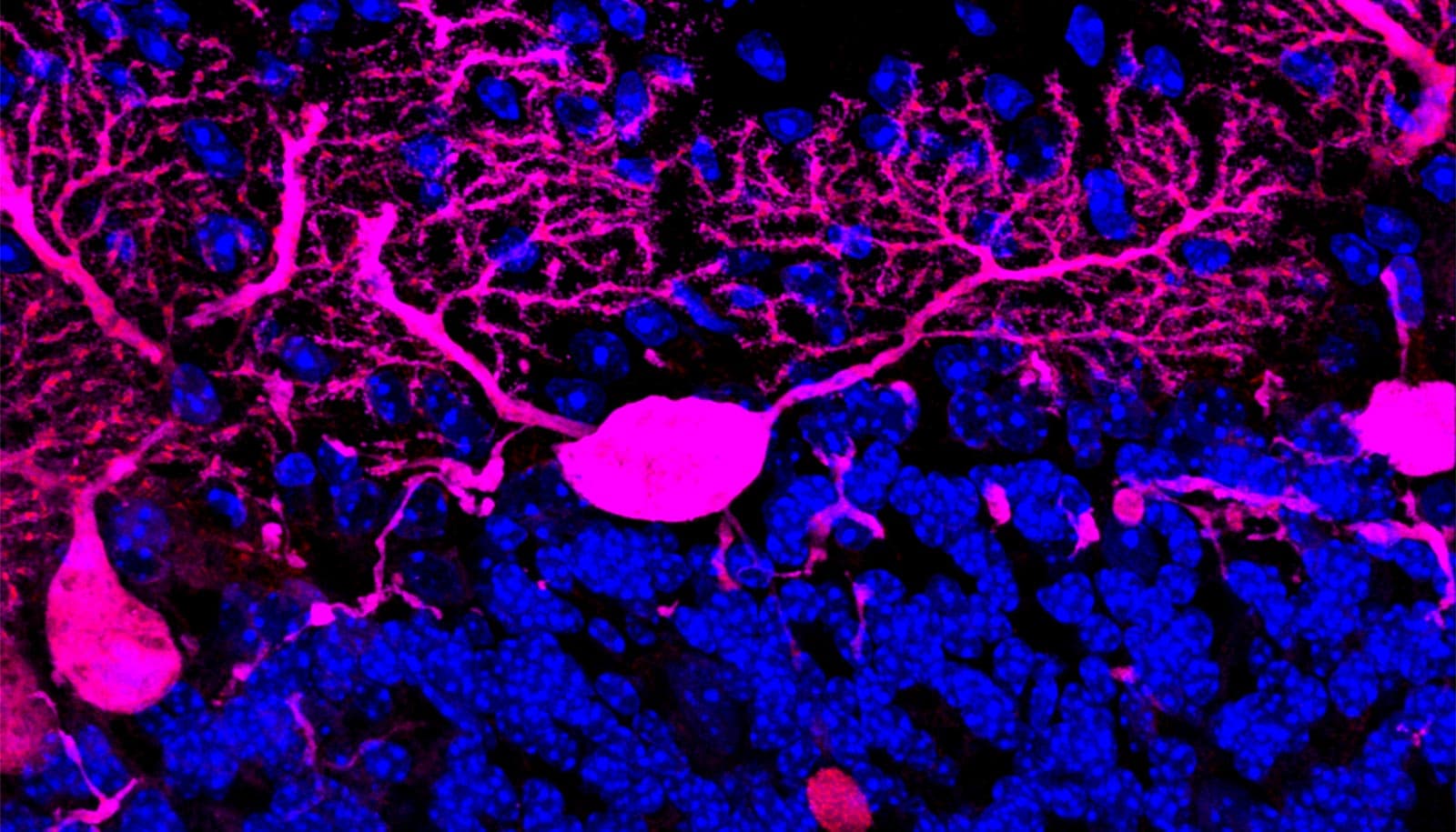 Long tendril-like neurons show up pink against a black background