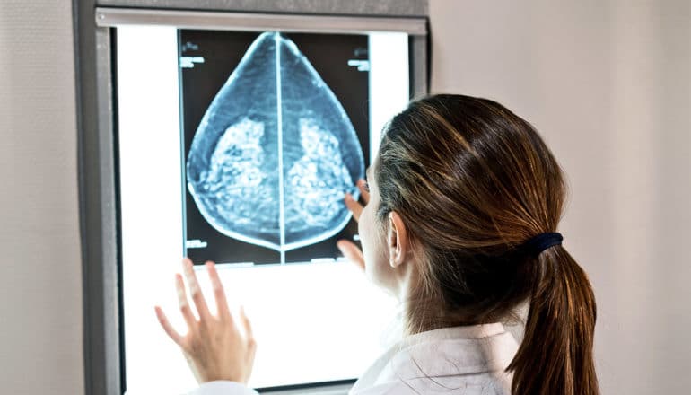 A doctor looks at a mammogram image against a lightboard