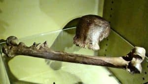 skull cap and femus in glass case