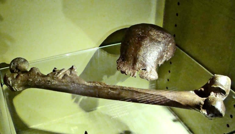 skull cap and femus in glass case