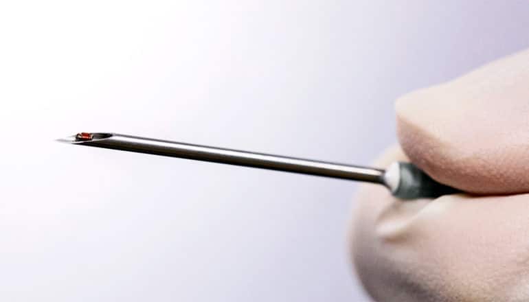 A gloved hand holds a needle that contains the tiny sensor