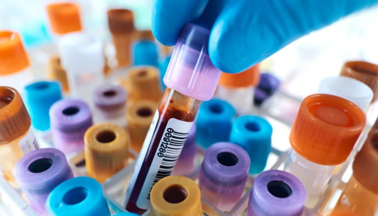 A person wearing blue gloves picks a blood sample in a vial with a purple lid from a group of them