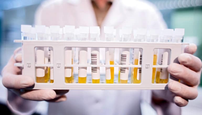 gloved hands hold rack of test tubes full of blood plasma