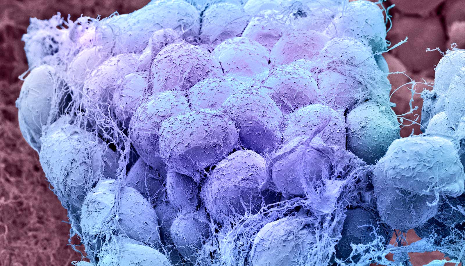 Body fat reveals immune differences between the sexes - Futurity