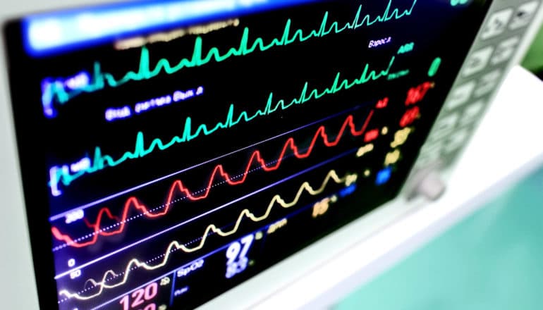 A screen shows vital signs as different colored lines with peaks and valleys in an ICU