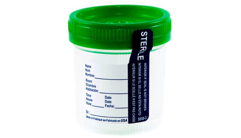 empty urine collection cup with "sterile" sticker