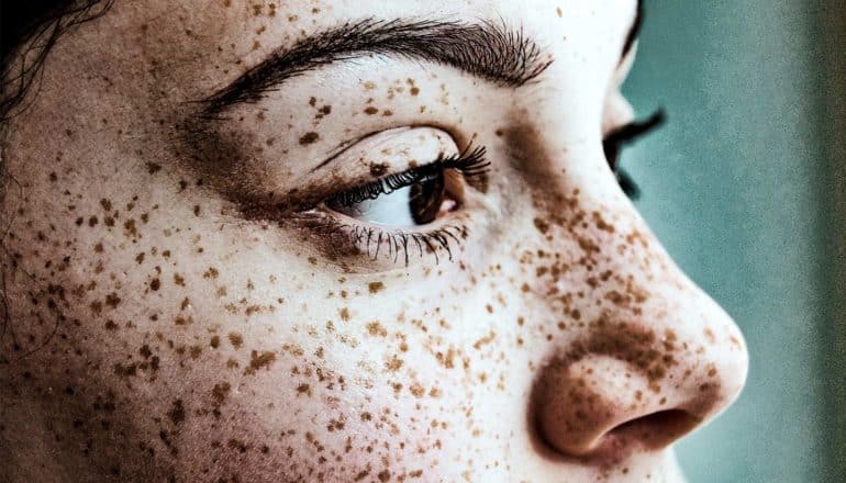 A young woman with freckles looks into the distance