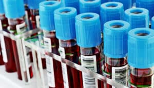 test tubes of blood in rack