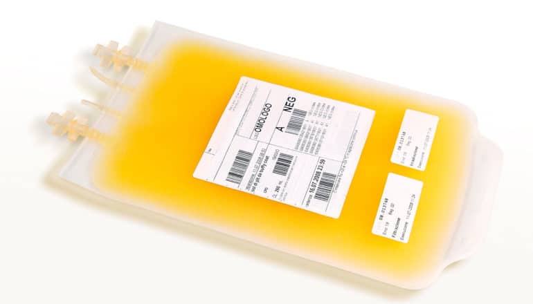 blood donation bag but filled with yellow fluid