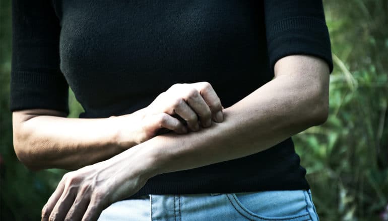 A person in a black shirt itches her arm