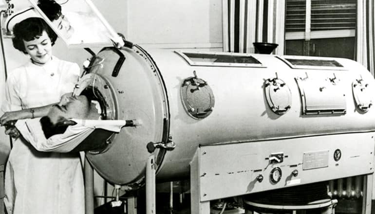 A person in an iron lung