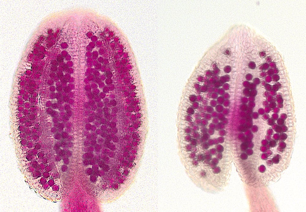 two ovals on stalks, one with more small spheres inside than the other