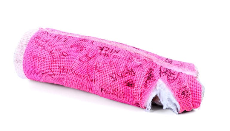 hot pink cast removed from arm