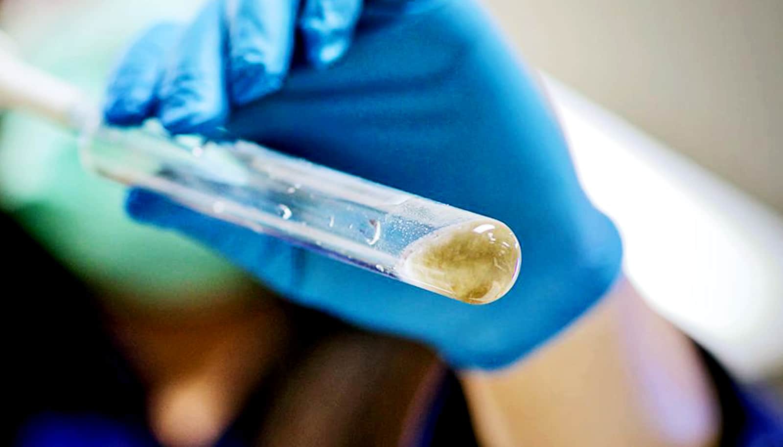 sludge-bacteria sludge-bacteria
