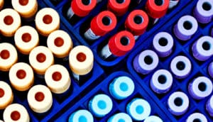 Many colored blood vials