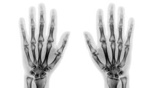 X-ray human hands